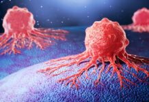 Рак підшлункової залози: нове дослідження показує, як пухлини захоплюють здорові тканини для поширення