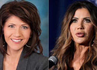 «Обличчя Мар-а-Лаго»: як екстремальна косметична хірургія стала політичним сигналом