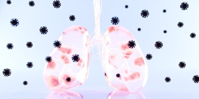 d2c5017a-d0a0-462f-ace6-54e21f3ebb98