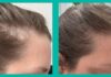 Огляд пептидів Omi WellBeauty: чи дійсно працюють добавки для боротьби з випаданням волосся, викликаним гормонами та стресом?