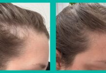 Recenze peptidů Omi WellBeauty: skutečně fungují doplňky proti vypadávání vlasů způsobené hormony a stresem?