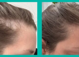 Огляд пептидів Omi WellBeauty: чи дійсно працюють добавки для боротьби з випаданням волосся, викликаним гормонами та стресом?