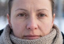 Чому ваша «жирна» шкіра насправді суха і як зупинити ефект віддачі